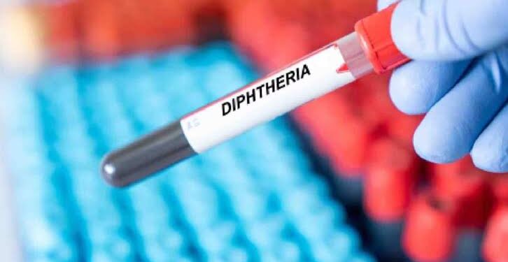 FG  Cautions Against Diphtheria, Says  Everyone At  Risk  As Nigeria Records 798 Cases