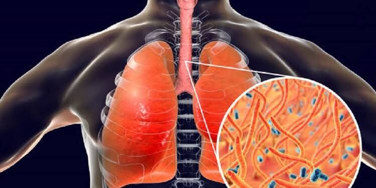 Diphtheria Claims 453 Lives In 18 States, FCT
