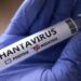 New Hantavirus Case Suspected On Remote Island As Contact Tracing Continues 