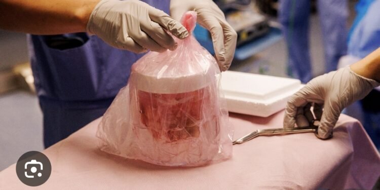 Pig Kidney Functions In Patient For Record 271 Days Before Being Replaced With Human Organ